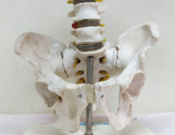 Pelvi Acetabular Surgery