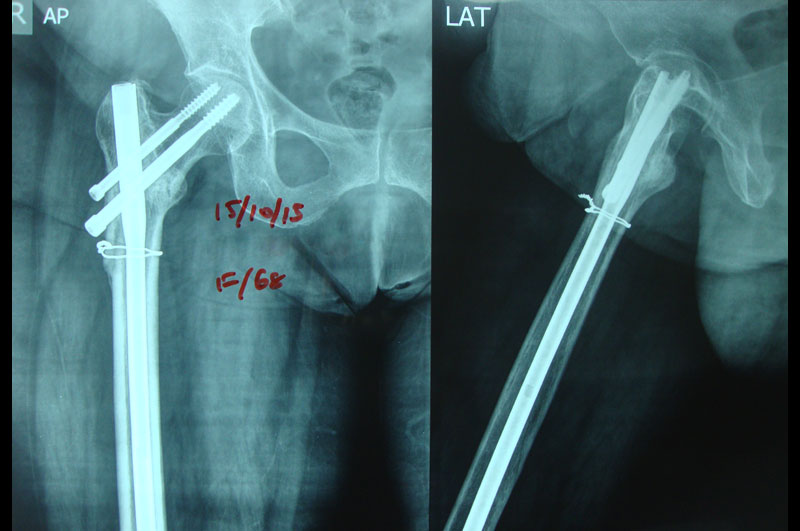 Trauma Surgery