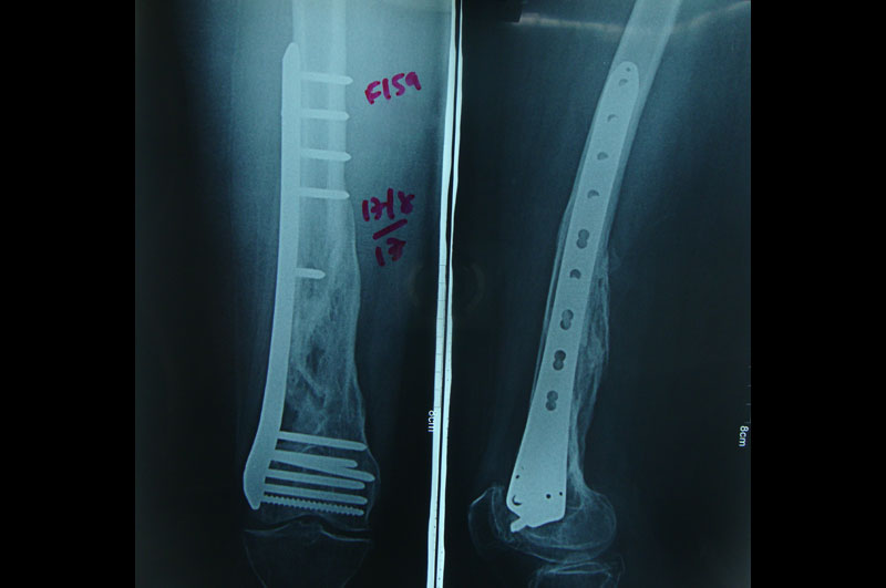 Trauma Surgery